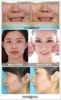 整形手术爆料视频大全最新,最新爆料视频大全深度解析  第3张